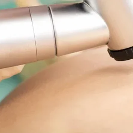 Дерматоскопия